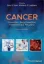 Picture of Book Cancer: Prevention, Early Detection, Treatment and Recovery
