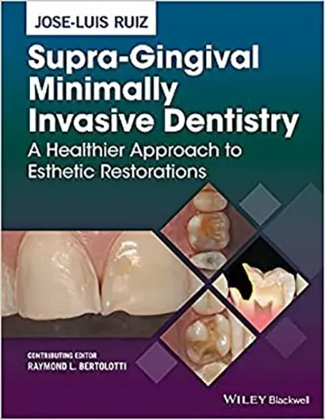 Imagem de Supra-Gingival Minimally Invasive Dentistry: A Healthier Approach to Esthetic Restorations