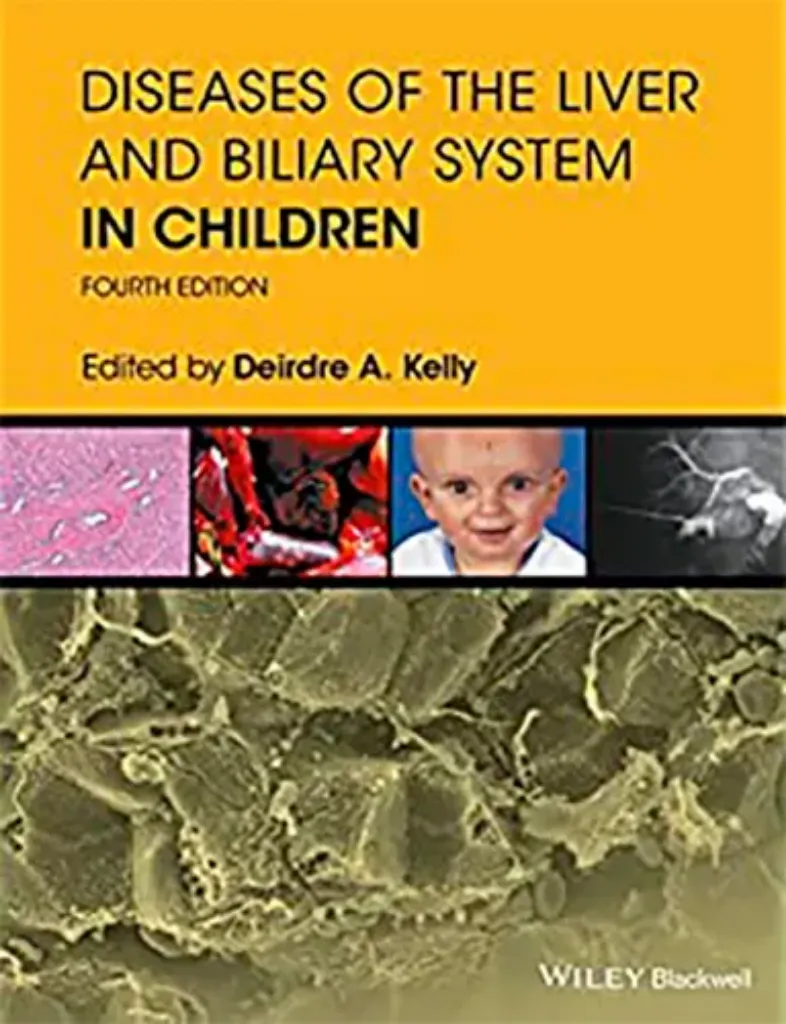Imagem de Diseases of the Liver and Biliary System in Children