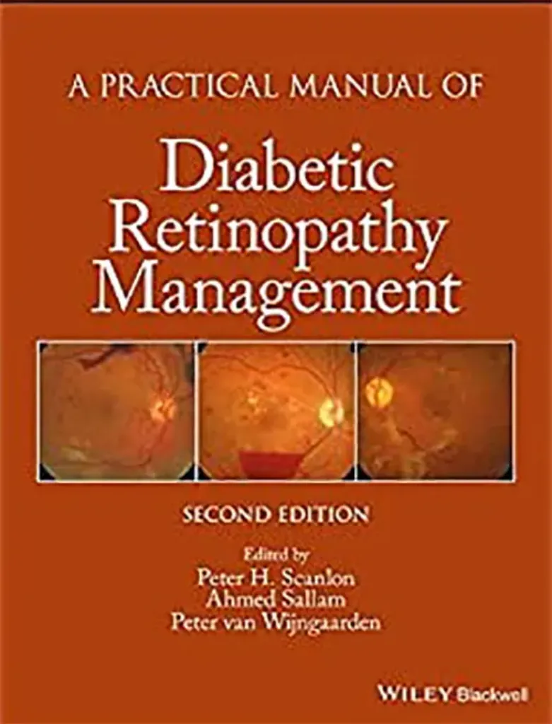 Imagem de A Practical Manual of Diabetic Retinopathy Management