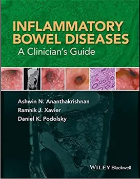 Imagem de Inflammatory Bowel Diseases: A Clinician's Guide