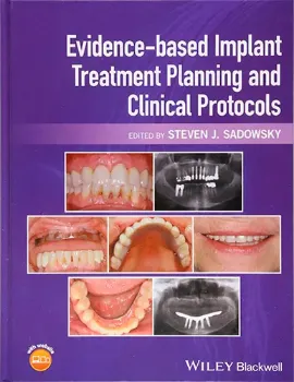 Picture of Book Evidence-Based Implant Treatment Planning and Clinical Protocols
