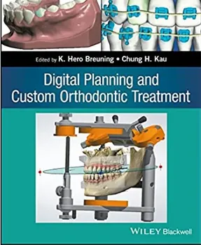 Picture of Book Digital Planning and Custom Orthodontic Treatment