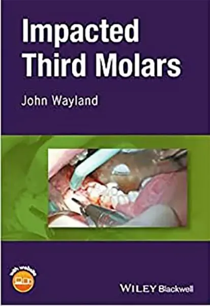 Imagem de Impacted Third Molars