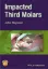 Picture of Book Impacted Third Molars