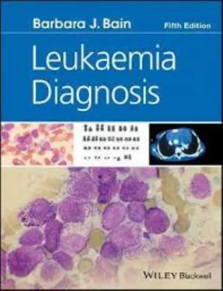 Imagem de Leukaemia Diagnosis