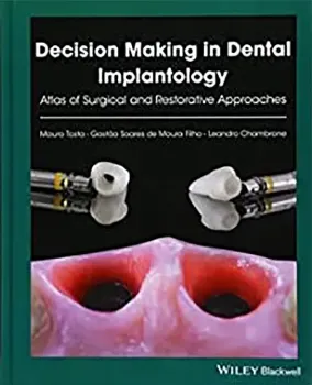 Imagem de Decision Making in Dental Implantology: Atlas of Surgical and Restorative Approaches