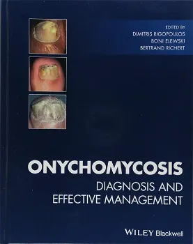 Picture of Book Onychomycosis: Diagnosis and Effective Management