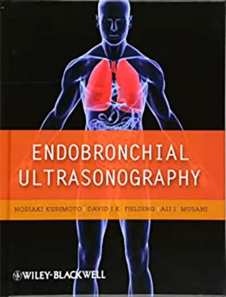 Imagem de Endobronchial Ultrasonography