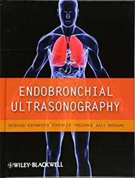 Imagem de Endobronchial Ultrasonography