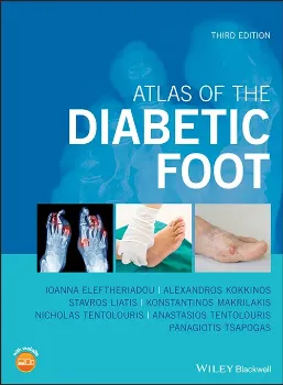 Imagem de Atlas of the Diabetic Foot