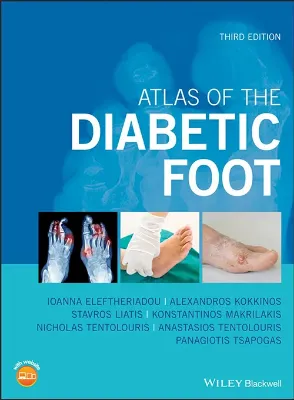 Imagem de Atlas of the Diabetic Foot