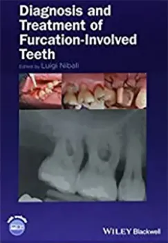 Imagem de Diagnosis and Treatment of Furcation-Involved Teeth