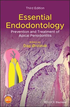 Imagem de Essential Endodontology: Prevention and Treatment of Apical Periodontitis