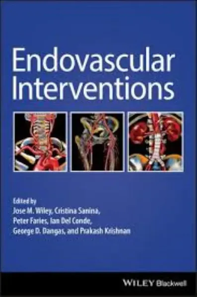 Imagem de Endovascular Interventions