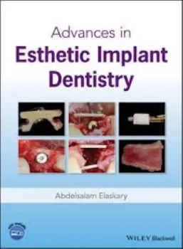 Picture of Book Advances in Esthetic Implant Dentistry