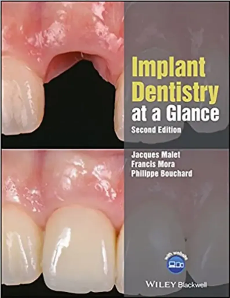 Imagem de Implant Dentistry at a Glance