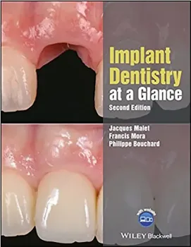Picture of Book Implant Dentistry at a Glance