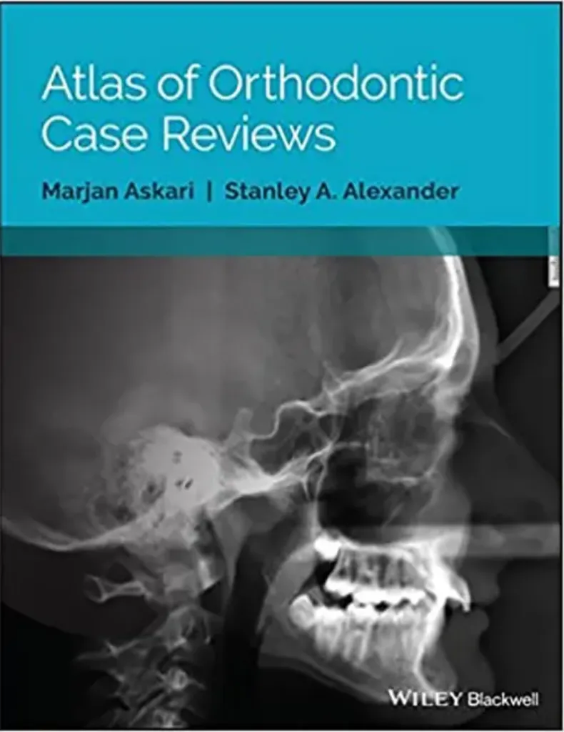 Imagem de Atlas of Orthodontic: Case Reviews
