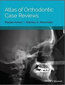 Imagem de Atlas of Orthodontic: Case Reviews