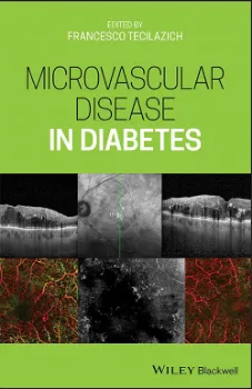 Imagem de Microvascular Disease in Diabetes