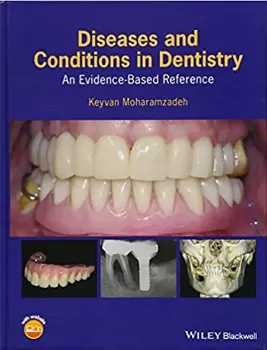 Imagem de Diseases and Conditions in Dentistry: An Evidence-Based Reference