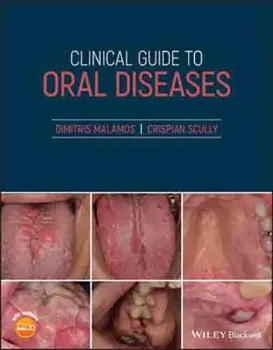 Imagem de Clinical Guide to Oral Diseases