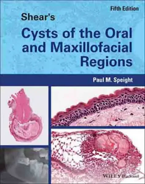 Picture of Book Shear's Cysts of the Oral and Maxillofacial Regions