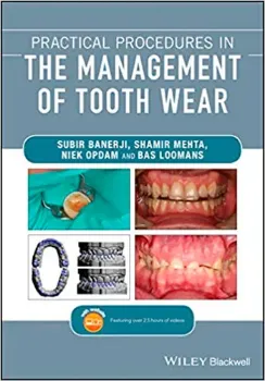 Imagem de Practical Procedures in the Management of Tooth Wear