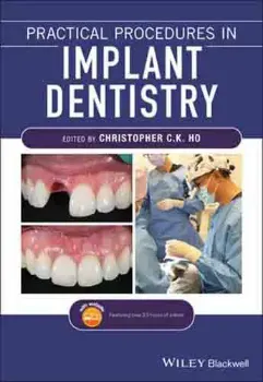 Picture of Book Practical Procedures in Implant Dentistry