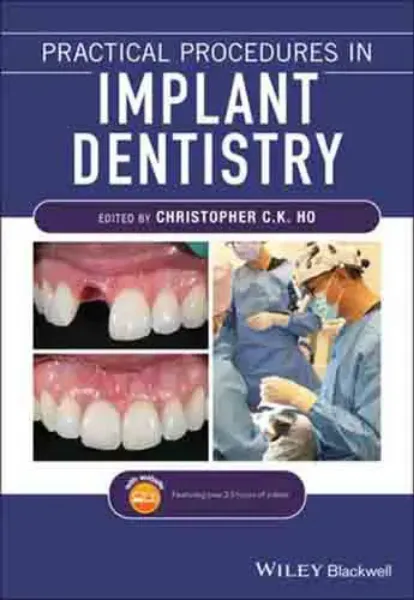 Imagem de Practical Procedures in Implant Dentistry