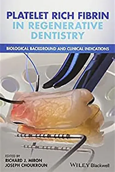 Imagem de Platelet Rich Fibrin in Regenerative Dentistry: Biological Background and Clinical Indications