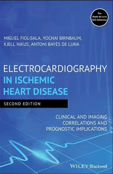 Imagem de Electrocardiography in Ischemic Heart Disease: Clinical and Imaging Correlations and Prognostic Implications