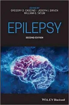 Imagem de Epilepsy