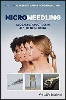 Imagem de Microneedling: Global Perspectives in Aesthetic Medicine