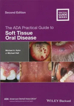 Picture of Book The ADA Practical Guide to Soft Tissue Oral Disease