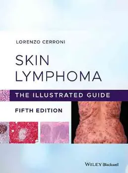 Picture of Book Skin Lymphoma - The Illustrated Guide