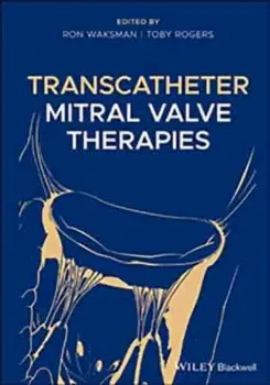 Picture of Book Transcatheter Mitral Valve Therapies