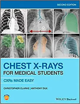 Picture of Book Chest X-Rays for Medical Students: CXRs Made Easy