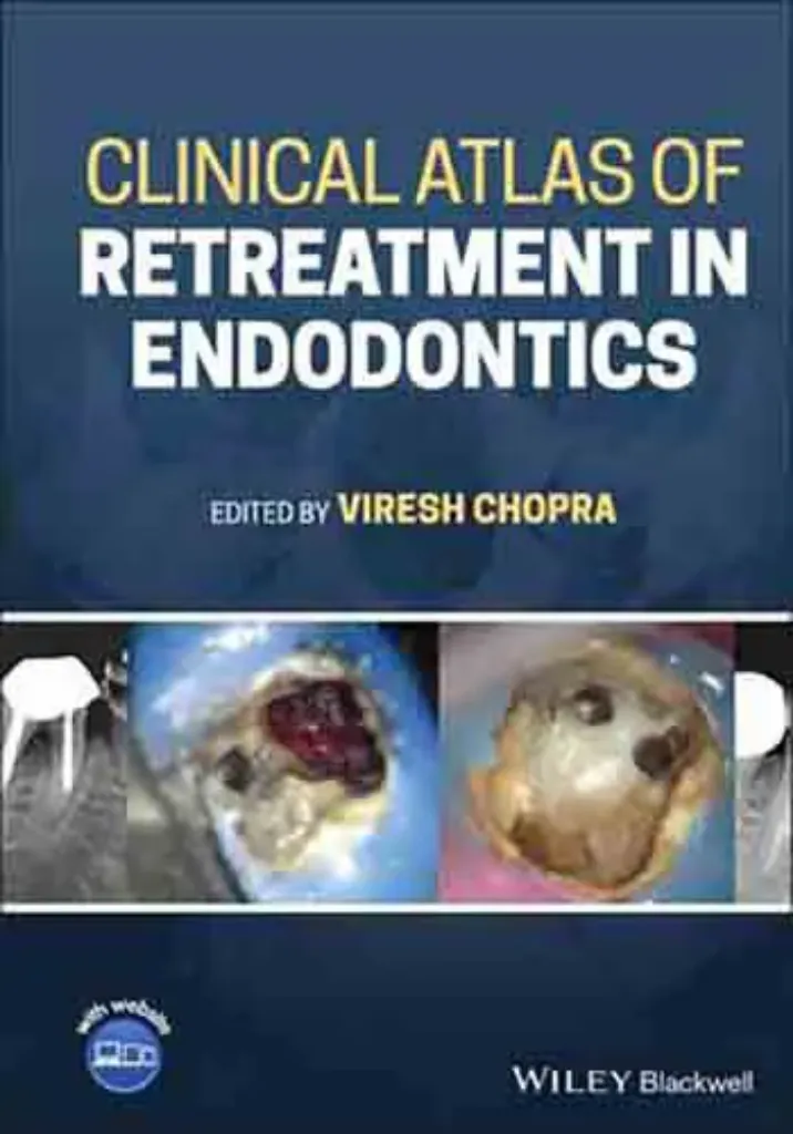 Imagem de Clinical Atlas of Retreatment in Endodontics
