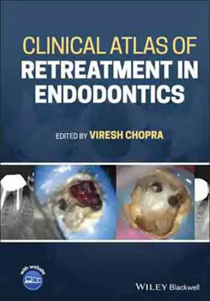 Imagem de Clinical Atlas of Retreatment in Endodontics