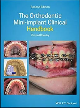 Imagem de The Orthodontic Mini-implant Clinical Handbook