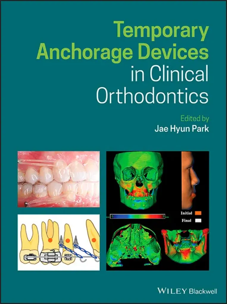 Imagem de Temporary Anchorage Devices in Clinical Orthodontics