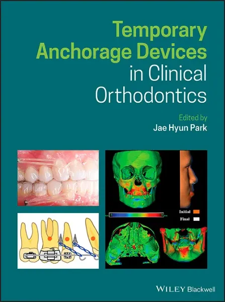 Imagem de Temporary Anchorage Devices in Clinical Orthodontics