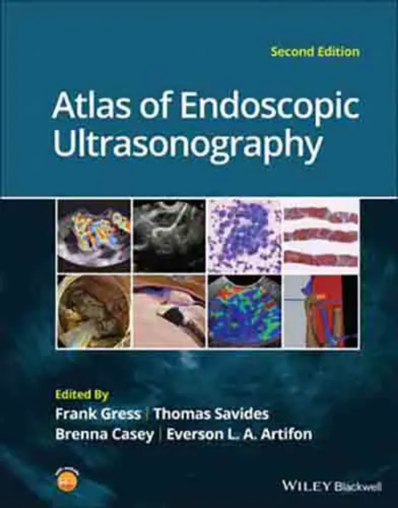 Imagem de Atlas of Endoscopic Ultrasonography