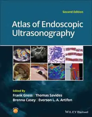 Imagem de Atlas of Endoscopic Ultrasonography