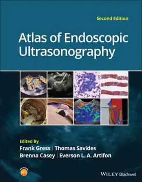 Imagem de Atlas of Endoscopic Ultrasonography