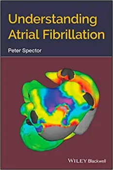 Imagem de Understanding Atrial Fibrillation