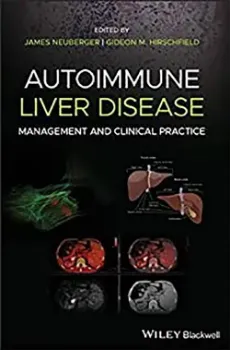 Imagem de Autoimmune Liver Disease: Management and Clinical Practice