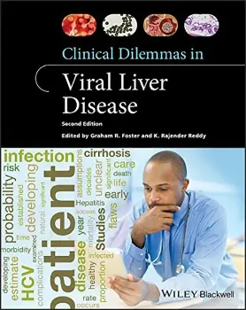 Imagem de Clinical Dilemmas in Viral Liver Disease